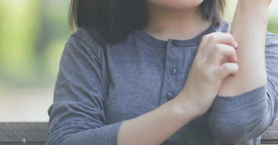 Atopic Dermatitis Day: Everything You Need To Know About This Skin Condition